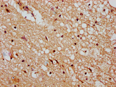 Immunofluorescence staining of Hela cells with CAC15667 at 1:133, counter-stained with DAPI. The cells were fixed in 4% formaldehyde, permeabilized using 0.2% Triton X-100 and blocked in 10% normal Goat Serum. The cells were then incubated with the antibody overnight at 4°C. The secondary antibody was Alexa Fluor 488-congugated AffiniPure Goat Anti-Rabbit IgG(H+L).