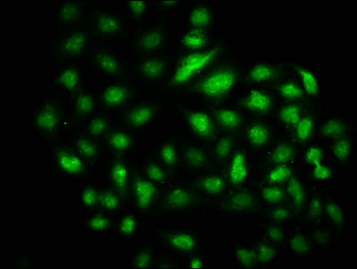 DMAP1 Polyclonal Antibody - image 4
