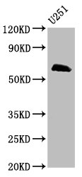 MSL2 Polyclonal Antibody - image 2