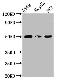 IFT52 Polyclonal Antibody - image 2