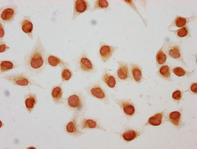 Chromatin Immunoprecipitation Hela (10 6 , treated with 30mM sodium butyrate for 4h) were treated with Micrococcal Nuclease, sonicated, and immunoprecipitated with 5ug anti-HIST1H1C (CAC15672) or a control normal rabbit IgG. The resulting ChIP DNA was quantified using real-time PCR with primers against the β-Globin promoter.