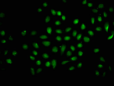 Chromatin Immunoprecipitation Hela (10 6 , treated with 30mM sodium butyrate for 4h) were treated with Micrococcal Nuclease, sonicated, and immunoprecipitated with 5ug anti-HIST1H1C (CAC15673) or a control normal rabbit IgG. The resulting ChIP DNA was quantified using real-time PCR with primers against the β-Globin promoter.