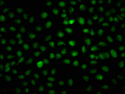 2-hydroxyisobutyryl-HIST1H1C (K168) Polyclonal Antibody - image 3
