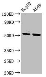 IHC image of CAC15693 diluted at 1:400 and staining in paraffin-embedded human cervical cancer performed on a Leica BondTM system. After dewaxing and hydration, antigen retrieval was mediated by high pressure in a citrate buffer (pH 6.0). Section was blocked with 10% normal goat serum 30min at RT. Then primary antibody (1% BSA) was incubated at 4°C overnight. The primary is detected by a biotinylated secondary antibody and visualized using an HRP conjugated SP system.