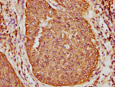 IHC image of CAC15693 diluted at 1:400 and staining in paraffin-embedded human tonsil tissue performed on a Leica BondTM system. After dewaxing and hydration, antigen retrieval was mediated by high pressure in a citrate buffer (pH 6.0). Section was blocked with 10% normal goat serum 30min at RT. Then primary antibody (1% BSA) was incubated at 4°C overnight. The primary is detected by a biotinylated secondary antibody and visualized using an HRP conjugated SP system.