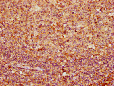 Immunofluorescence staining of MCF-7 cells with CAC15693 at 1:133, counter-stained with DAPI. The cells were fixed in 4% formaldehyde, permeabilized using 0.2% Triton X-100 and blocked in 10% normal Goat Serum. The cells were then incubated with the antibody overnight at 4°C. The secondary antibody was Alexa Fluor 488-congugated AffiniPure Goat Anti-Rabbit IgG(H+L).
