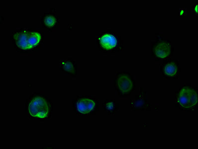KRT16 Polyclonal Antibody - image 5