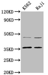 MAGEA2 Polyclonal Antibody - image 2