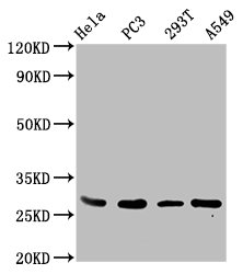 IHC image of CAC15702 diluted at 1:500 and staining in paraffin-embedded human kidney tissue performed on a Leica BondTM system. After dewaxing and hydration, antigen retrieval was mediated by high pressure in a citrate buffer (pH 6.0). Section was blocked with 10% normal goat serum 30min at RT. Then primary antibody (1% BSA) was incubated at 4°C overnight. The primary is detected by a biotinylated secondary antibody and visualized using an HRP conjugated SP system.