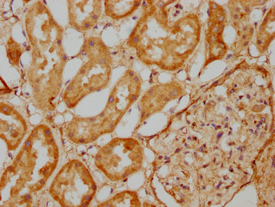 Immunofluorescence staining of A549 cells with CAC15702 at 1:166, counter-stained with DAPI. The cells were fixed in 4% formaldehyde, permeabilized using 0.2% Triton X-100 and blocked in 10% normal Goat Serum. The cells were then incubated with the antibody overnight at 4°C. The secondary antibody was Alexa Fluor 488-congugated AffiniPure Goat Anti-Rabbit IgG(H+L).