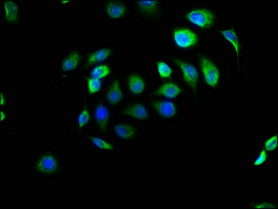 EFHD1 Polyclonal Antibody - image 4