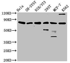 KMT2E Polyclonal Antibody - image 2