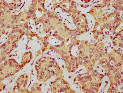 Immunofluorescence staining of Hela cells with CAC15714 at 1:2.5, counter-stained with DAPI. The cells were fixed in 4% formaldehyde, permeabilized using 0.2% Triton X-100 and blocked in 10% normal Goat Serum. The cells were then incubated with the antibody overnight at 4°C. The secondary antibody was Alexa Fluor 488-congugated AffiniPure Goat Anti-Rabbit IgG(H+L).