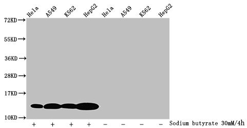 Immunocytochemistry analysis of CAC15715 diluted at 1:30 and staining in Hela cells (treated with 30mM sodium butyrate for 4h) performed on a Leica BondTM system. The cells were fixed in 4% formaldehyde, permeabilized using 0.2% Triton X-100 and blocked with 10% normal goat serum 30min at RT. Then primary antibody (1% BSA) was incubated at 4°C overnight. The primary is detected by a biotinylated secondary antibody and visualized using an HRP conjugated SP system.