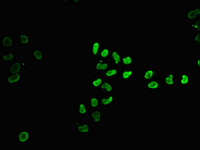 Immunoprecipitating HIST1H4A in HepG2 whole cell lysate (treated with 30mM sodium butyrate for 4h), Lane 1: Rabbit control IgG instead of CAC15715 in HepG2 whole cell lysate (treated with 30mM sodium butyrate for 4h). For western blotting, a HRP-conjugated Protein G antibody was used as the secondary antibody (1/2000), Lane 2: CAC15715 (3ug) + HepG2 whole cell lysate (treated with 30mM sodium butyrate for 4h) (500ug), Lane 3: HepG2 whole cell lysate (treated with 30mM sodium butyrate for 4h) (20ug)