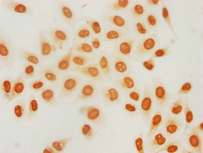 Immunofluorescence staining of Hela cells (treated with 30mM sodium butyrate for 4h) with CAC15716 at 1:12.5, counter-stained with DAPI. The cells were fixed in 4% formaldehyde, permeabilized using 0.2% Triton X-100 and blocked in 10% normal Goat Serum. The cells were then incubated with the antibody overnight at 4°C. The secondary antibody was Alexa Fluor 488-congugated AffiniPure Goat Anti-Rabbit IgG(H+L).