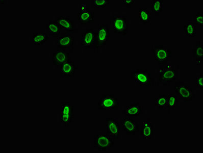Chromatin Immunoprecipitation Hela (4*10 6 , treated with 30mM sodium butyrate for 4h) were treated with Micrococcal Nuclease, sonicated, and immunoprecipitated with 5ug anti-HIST1H3A (CAC15716) or a control normal rabbit IgG. The resulting ChIP DNA was quantified using real-time PCR with primers against the β-Globin promoter.