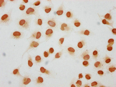 Immunofluorescence staining of Hela cells (treated with 30mM sodium butyrate for 4h) with CAC15718 at 1:25, counter-stained with DAPI. The cells were fixed in 4% formaldehyde, permeabilized using 0.2% Triton X-100 and blocked in 10% normal Goat Serum. The cells were then incubated with the antibody overnight at 4°C. The secondary antibody was Alexa Fluor 488-congugated AffiniPure Goat Anti-Rabbit IgG(H+L).