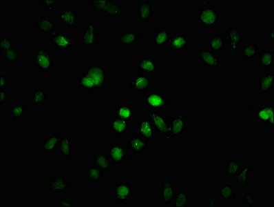 Chromatin Immunoprecipitation Hela (4*10 6 , treated with 30mM sodium butyrate for 4h) were treated with Micrococcal Nuclease, sonicated, and immunoprecipitated with 5ug anti-HIST1H1C (CAC15718) or a control normal rabbit IgG. The resulting ChIP DNA was quantified using real-time PCR with primers against the β-Globin promoter.