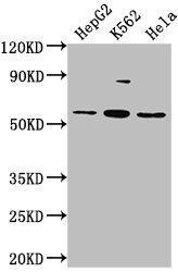 Immunofluorescence staining of HepG2 cells with CAC15719 at 1:50, counter-stained with DAPI. The cells were fixed in 4% formaldehyde, permeabilized using 0.2% Triton X-100 and blocked in 10% normal Goat Serum. The cells were then incubated with the antibody overnight at 4°C. The secondary antibody was Alexa Fluor 488-congugated AffiniPure Goat Anti-Rabbit IgG(H+L).