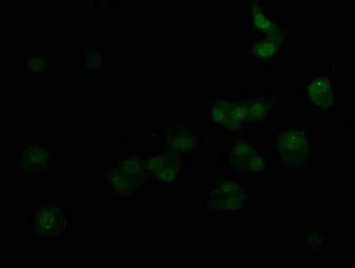 ADRA1A Polyclonal Antibody - image 3