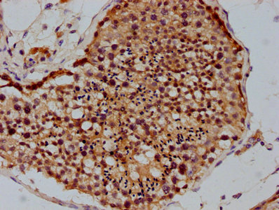 IHC image of CAC15722 diluted at 1:100 and staining in paraffin-embedded human brain tissue performed on a Leica BondTM system. After dewaxing and hydration, antigen retrieval was mediated by high pressure in a citrate buffer (pH 6.0). Section was blocked with 10% normal goat serum 30min at RT. Then primary antibody (1% BSA) was incubated at 4°C overnight. The primary is detected by a biotinylated secondary antibody and visualized using an HRP conjugated SP system.