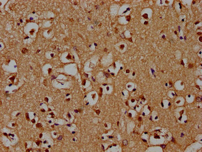 PSMD4 Polyclonal Antibody - image 4