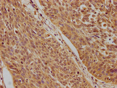 TP73 Polyclonal Antibody - image 3