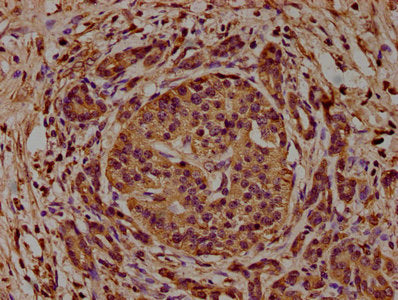 Immunofluorescence staining of U251 cells with CAC15733 at 1:100, counter-stained with DAPI. The cells were fixed in 4% formaldehyde, permeabilized using 0.2% Triton X-100 and blocked in 10% normal Goat Serum. The cells were then incubated with the antibody overnight at 4°C. The secondary antibody was Alexa Fluor 488-congugated AffiniPure Goat Anti-Rabbit IgG(H+L).