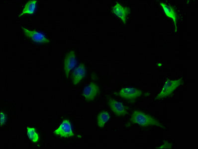 CAP1 Polyclonal Antibody - image 5