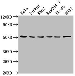 IHC image of CAC15734 diluted at 1:100 and staining in paraffin-embedded human placenta tissue performed on a Leica BondTM system. After dewaxing and hydration, antigen retrieval was mediated by high pressure in a citrate buffer (pH 6.0). Section was blocked with 10% normal goat serum 30min at RT. Then primary antibody (1% BSA) was incubated at 4°C overnight. The primary is detected by a biotinylated secondary antibody and visualized using an HRP conjugated SP system.