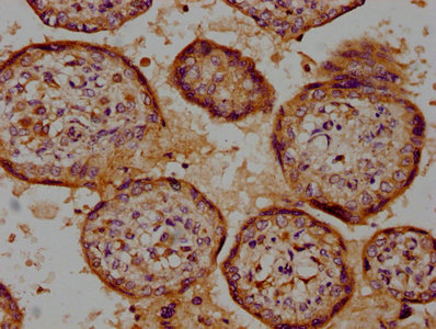 CSK Polyclonal Antibody - image 3