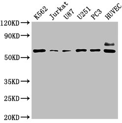IHC image of CAC15737 diluted at 1:30 and staining in paraffin-embedded human skeletal muscle tissue performed on a Leica BondTM system. After dewaxing and hydration, antigen retrieval was mediated by high pressure in a citrate buffer (pH 6.0). Section was blocked with 10% normal goat serum 30min at RT. Then primary antibody (1% BSA) was incubated at 4°C overnight. The primary is detected by a biotinylated secondary antibody and visualized using an HRP conjugated SP system.
