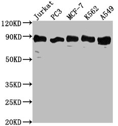 IHC image of CAC15754 diluted at 1:300 and staining in paraffin-embedded human kidney tissue performed on a Leica BondTM system. After dewaxing and hydration, antigen retrieval was mediated by high pressure in a citrate buffer (pH 6.0). Section was blocked with 10% normal goat serum 30min at RT. Then primary antibody (1% BSA) was incubated at 4°C overnight. The primary is detected by a biotinylated secondary antibody and visualized using an HRP conjugated SP system.