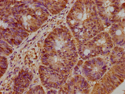 BRAT1 Polyclonal Antibody - image 4