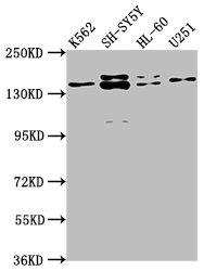 IHC image of CAC15756 diluted at 1:200 and staining in paraffin-embedded human endometrial cancer performed on a Leica BondTM system. After dewaxing and hydration, antigen retrieval was mediated by high pressure in a citrate buffer (pH 6.0). Section was blocked with 10% normal goat serum 30min at RT. Then primary antibody (1% BSA) was incubated at 4°C overnight. The primary is detected by a biotinylated secondary antibody and visualized using an HRP conjugated SP system.