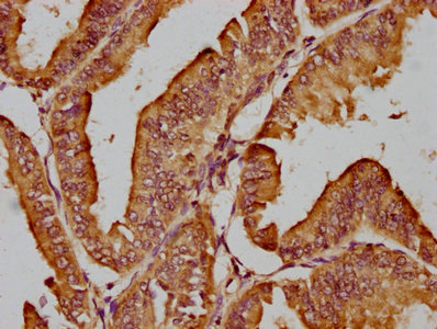 AHI1 Polyclonal Antibody - image 3
