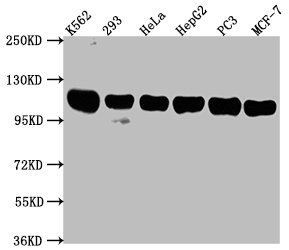 Immunofluorescence staining of HepG2 cells with CAC15758 at 1:133, counter-stained with DAPI. The cells were fixed in 4% formaldehyde, permeabilized using 0.2% Triton X-100 and blocked in 10% normal Goat Serum. The cells were then incubated with the antibody overnight at 4°C. The secondary antibody was Alexa Fluor 488-congugated AffiniPure Goat Anti-Rabbit IgG(H+L).