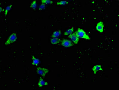 ITCH Polyclonal Antibody - image 3