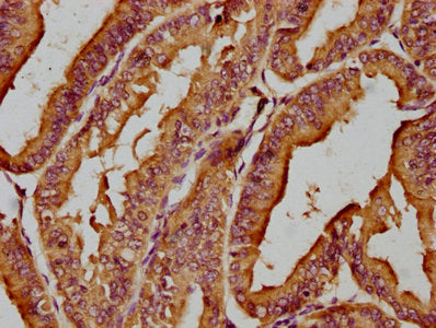 Immunofluorescence staining of Hela cells with CAC15759 at 1:100, counter-stained with DAPI. The cells were fixed in 4% formaldehyde, permeabilized using 0.2% Triton X-100 and blocked in 10% normal Goat Serum. The cells were then incubated with the antibody overnight at 4°C. The secondary antibody was Alexa Fluor 488-congugated AffiniPure Goat Anti-Rabbit IgG(H+L).
