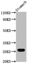 Gsta1 Polyclonal Antibody - image 2