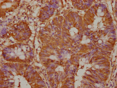 Immunofluorescence staining of A549 cells with CAC15765 at 1:50, counter-stained with DAPI. The cells were fixed in 4% formaldehyde, permeabilized using 0.2% Triton X-100 and blocked in 10% normal Goat Serum. The cells were then incubated with the antibody overnight at 4°C. The secondary antibody was Alexa Fluor 488-congugated AffiniPure Goat Anti-Rabbit IgG(H+L).