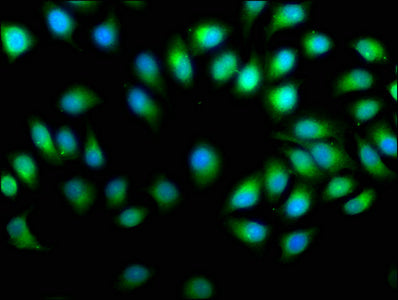 PREP Polyclonal Antibody - image 4