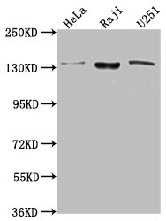 IHC image of CAC15770 diluted at 1:200 and staining in paraffin-embedded human lung cancer performed on a Leica BondTM system. After dewaxing and hydration, antigen retrieval was mediated by high pressure in a citrate buffer (pH 6.0). Section was blocked with 10% normal goat serum 30min at RT. Then primary antibody (1% BSA) was incubated at 4°C overnight. The primary is detected by a biotinylated secondary antibody and visualized using an HRP conjugated SP system.