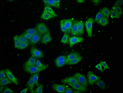 LARS Polyclonal Antibody - image 4
