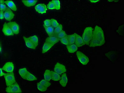 Western Blot, Positive WB detected in: COLO320 whole cell lysate, MCF-7 whole cell lysate, Hela whole cell lysate, All lanes: KRT20 antibody at 1:2000, Secondary, Goat polyclonal to rabbit IgG at 1/50000 dilution, Predicted band size: 49 kDa, Observed band size: 49 kDa