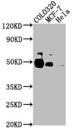 KRT20 Polyclonal Antibody - image 4