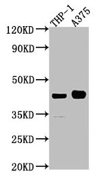 LRPAP1 Polyclonal Antibody - image 2