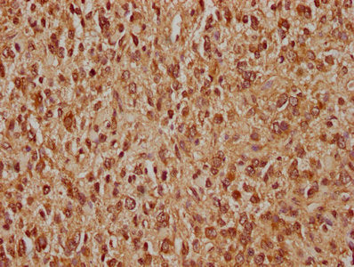 MDM2 Polyclonal Antibody - image 3