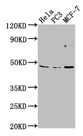 TMEM237 Polyclonal Antibody - image 2